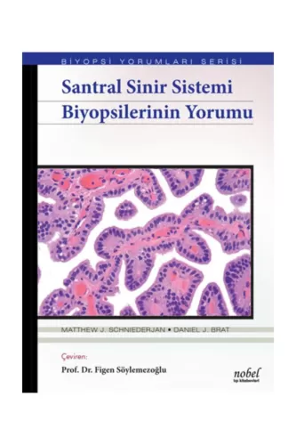 Santral Sinir Sistemi Biyopsilerinin Yorumu - Biyopsi Yorumları Serisi