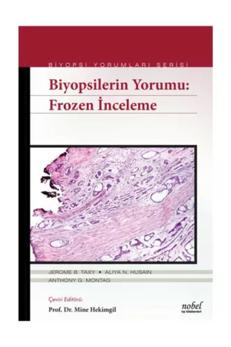 Biyopsilerin Yorumu: Frozen İnceleme - Biyopsi Yorumları Serisi