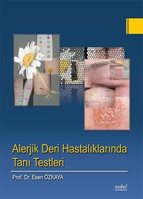 Alerjik Deri Hastalıklarında Tanı Testleri