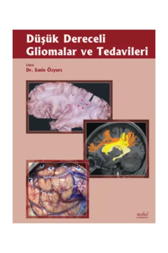 Düşük Dereceli Gliomalar ve Tedavileri