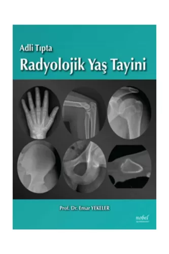 Adli Tıpta Radyolojik Yaş Tayini