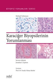 Karaciğer Biyopsilerinin Yorumlanması - Biyopsi Yorumları Serisi