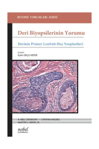 Deri Biyopsilerinin Yorumu: Derinin Primer Lenfoid-Dışı Neoplazileri