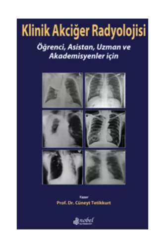 Klinik Akciğer Radyolojisi: Öğrenci, Asistan, Uzman ve Akademisyenler 