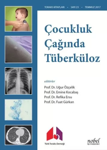 Çocukluk Çağında Tüberküloz Tanı: Tedavi ve Korumada Güncel Yaklaşımla