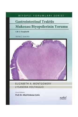 Gastrointestinal Traktüs Mukozası Biyopsilerinin Yorumu Cilt 2: Neopla