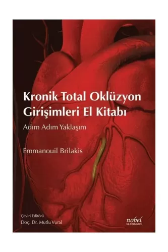 Kronik Total Oklüzyon Girişimleri El Kitabı: Adım Adım Yaklaşım