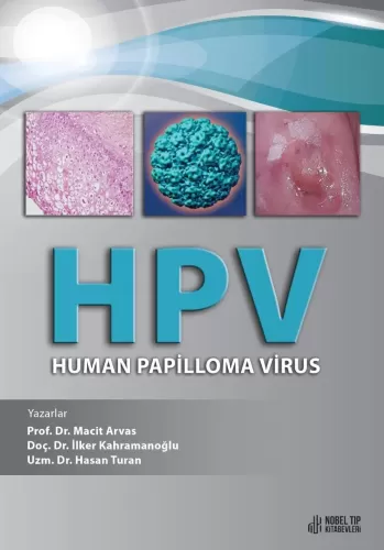 HPV - Human Papilloma Virus