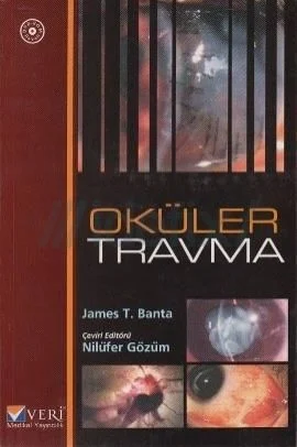 Oküler Travma