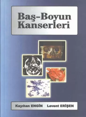 Baş Boyun Kanserleri