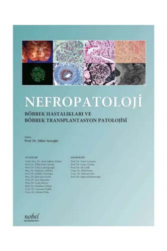 Nefropatoloji: Böbrek Hastalıkları ve Böbrek Transplantasyon Patolojis