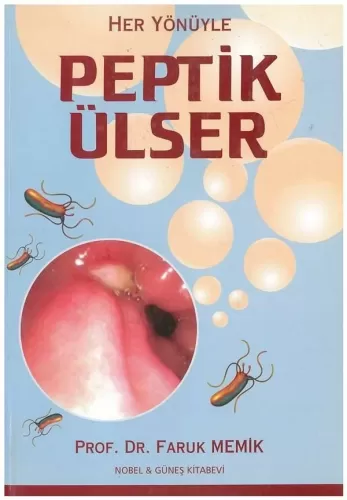 Peptik Ülser